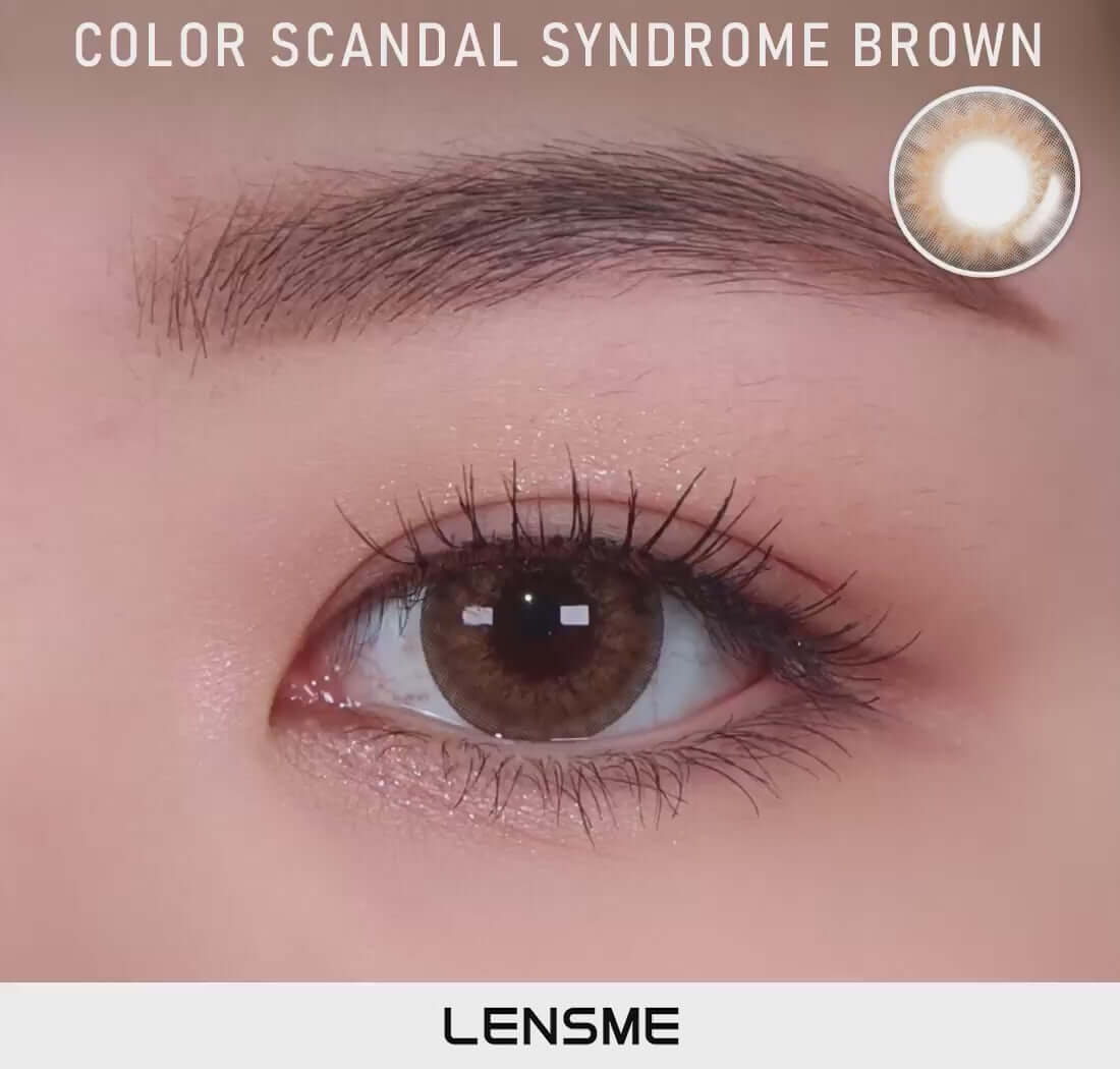 Syndrome Brown.